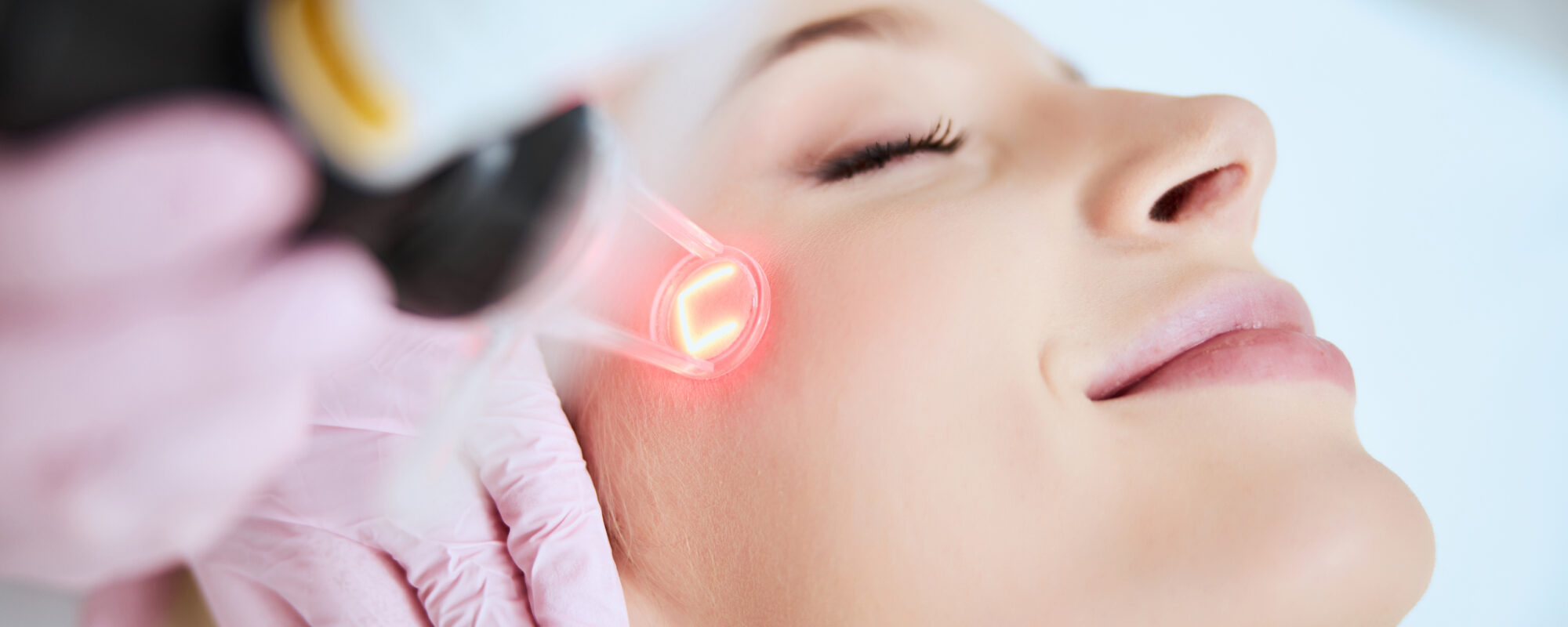 Resurfacing laserowy